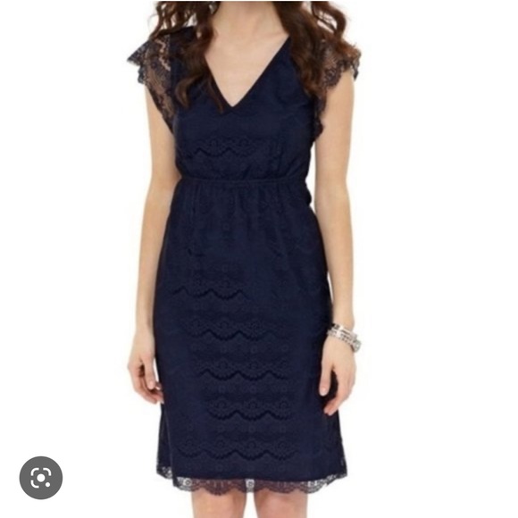 Fossil Penny Lace Cap Sleeve Dress Navy - Picture 1 of 15